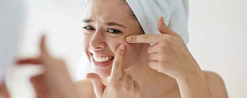 Acne-Treatment Acne Treatment